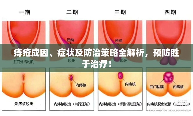 痔疮成因、症状及防治策略全解析，预防胜于治疗！